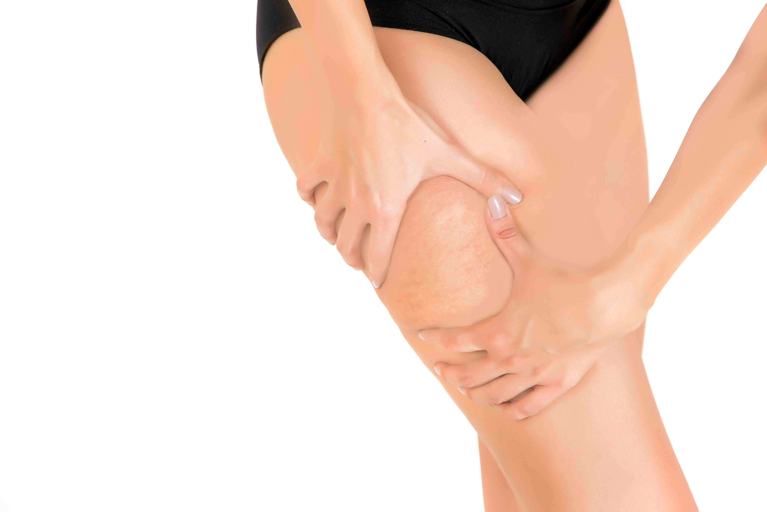 ritenzione idrica gambe