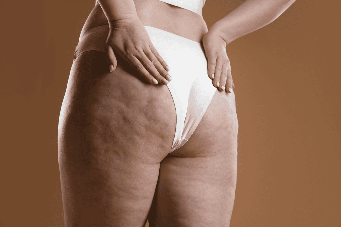 cellulite come si elimina