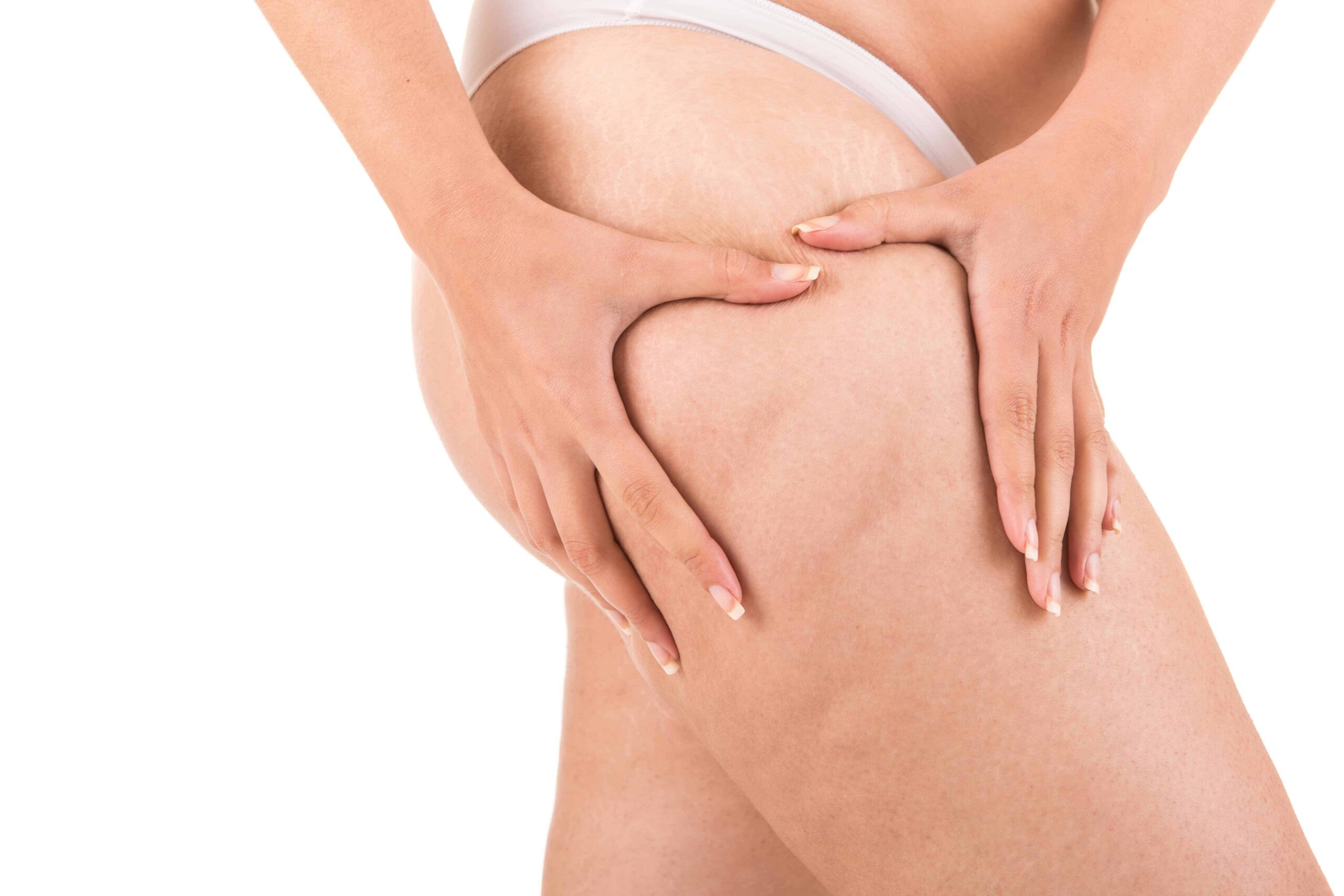 cellulite gambe magre