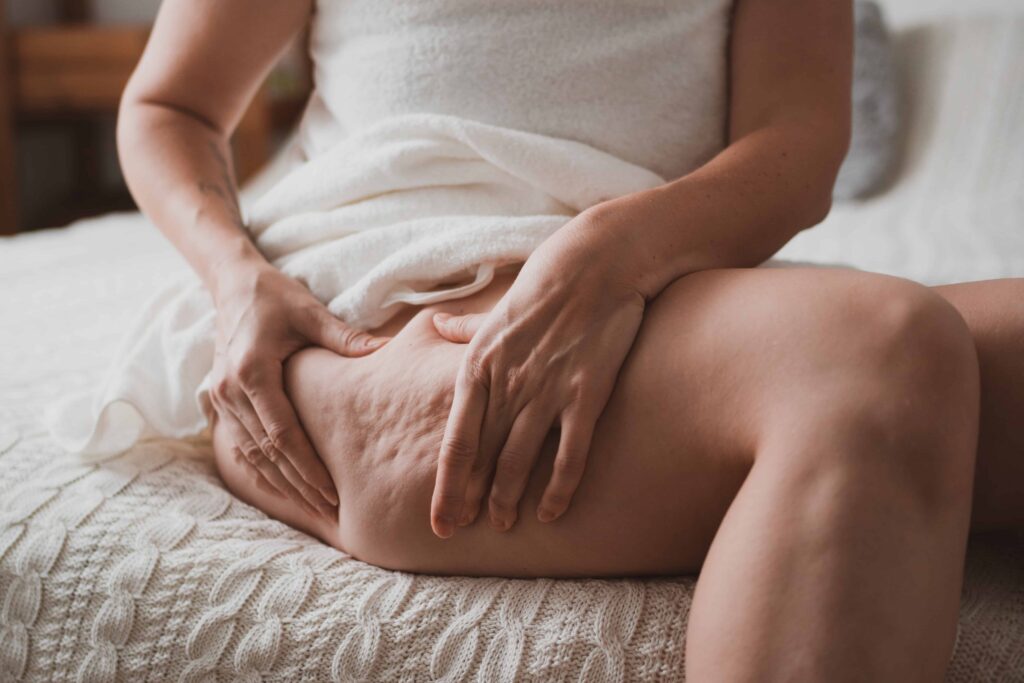 combattere cellulite