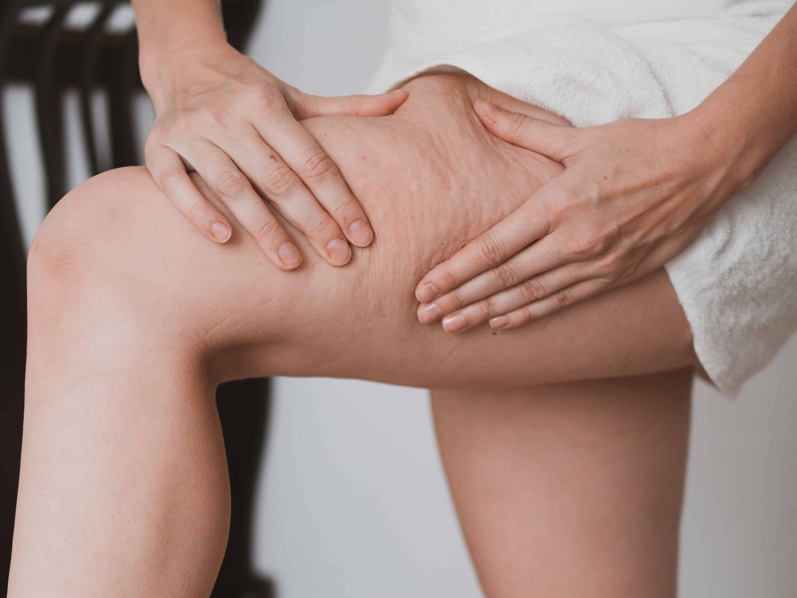 rimedi cellulite gambe magre