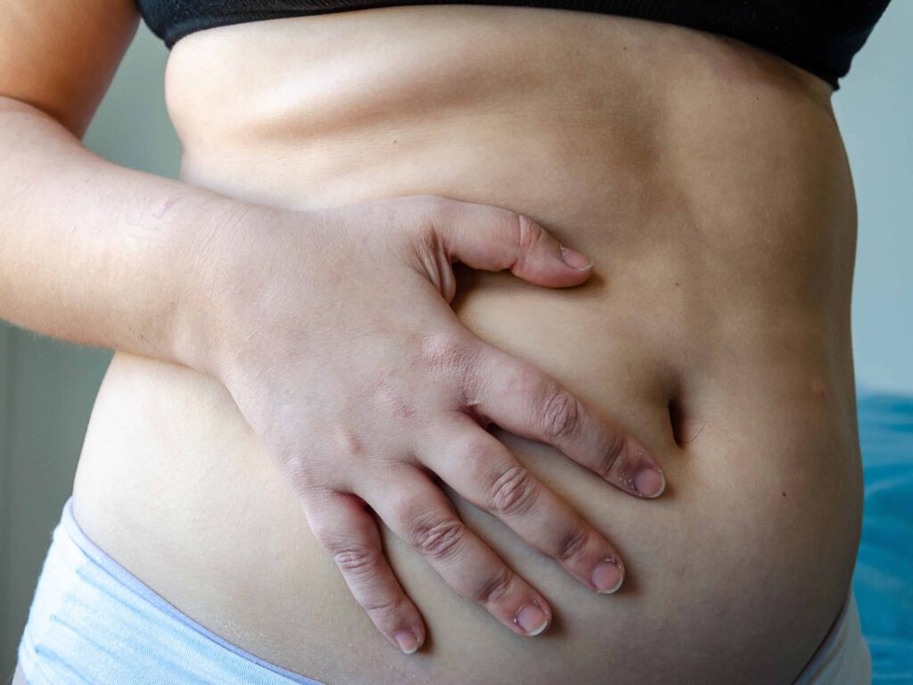 pancia gonfia menopausa