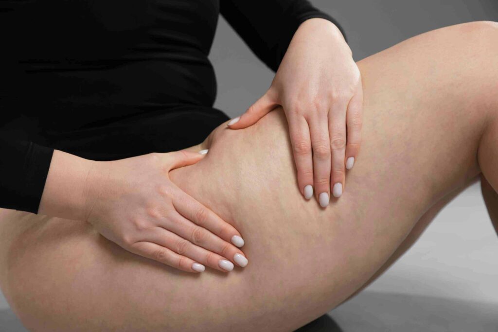 rimedi per sgonfiare le gambe